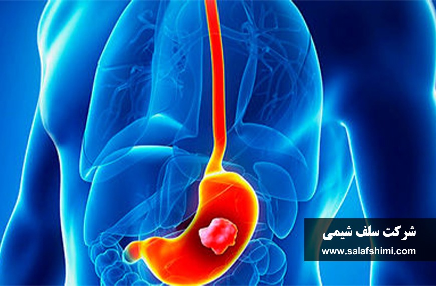 مصرف بی‌رویه کودهای شیمیایی عامل شیوع سرطان معده + سلف شیمی